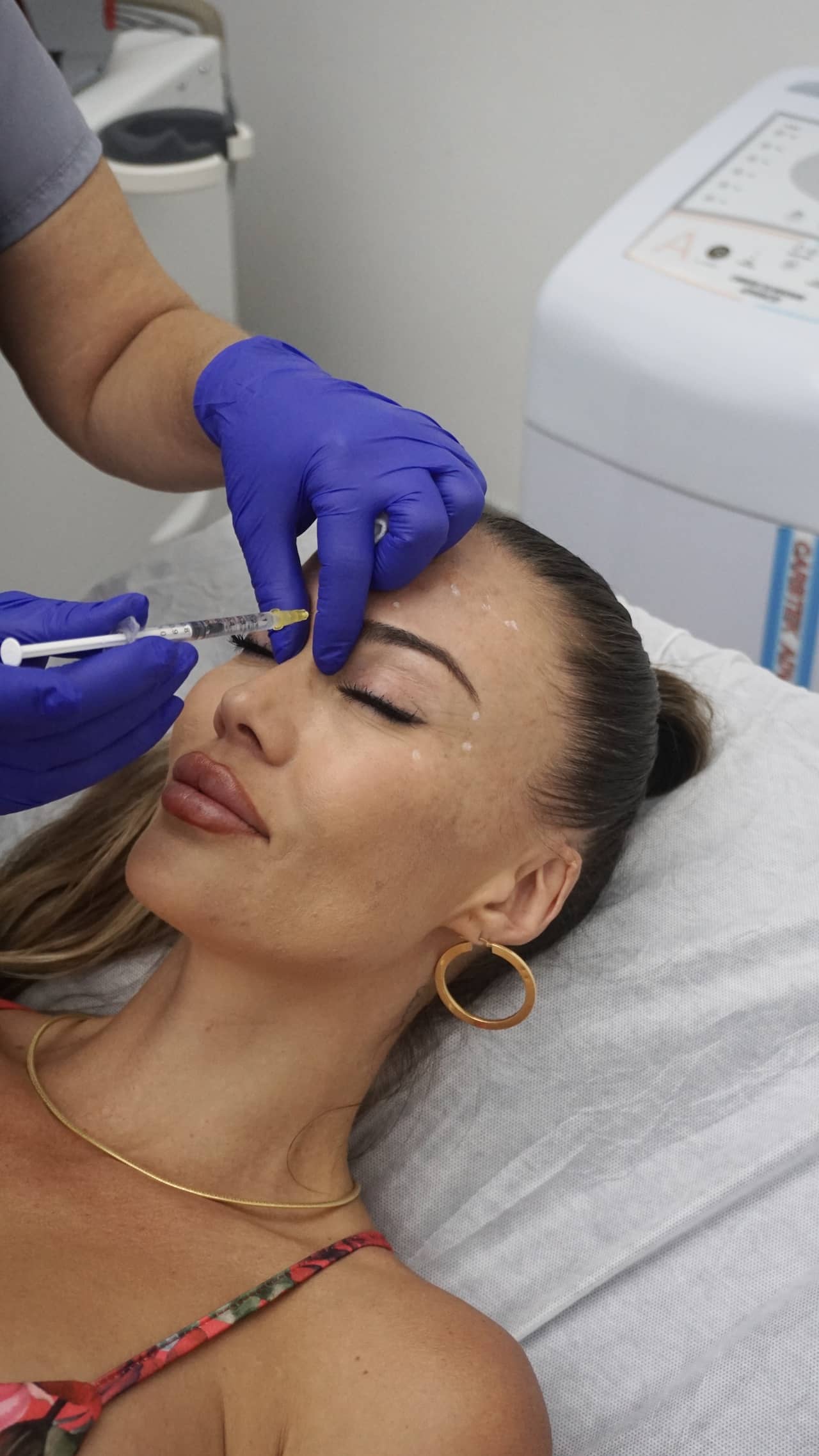 Tratamiento del tercio medio del rostro en Clínica Bonome