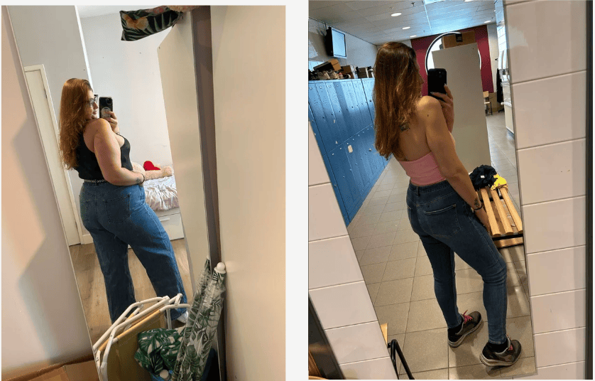 Caso clínico nutrición antes y después 2
