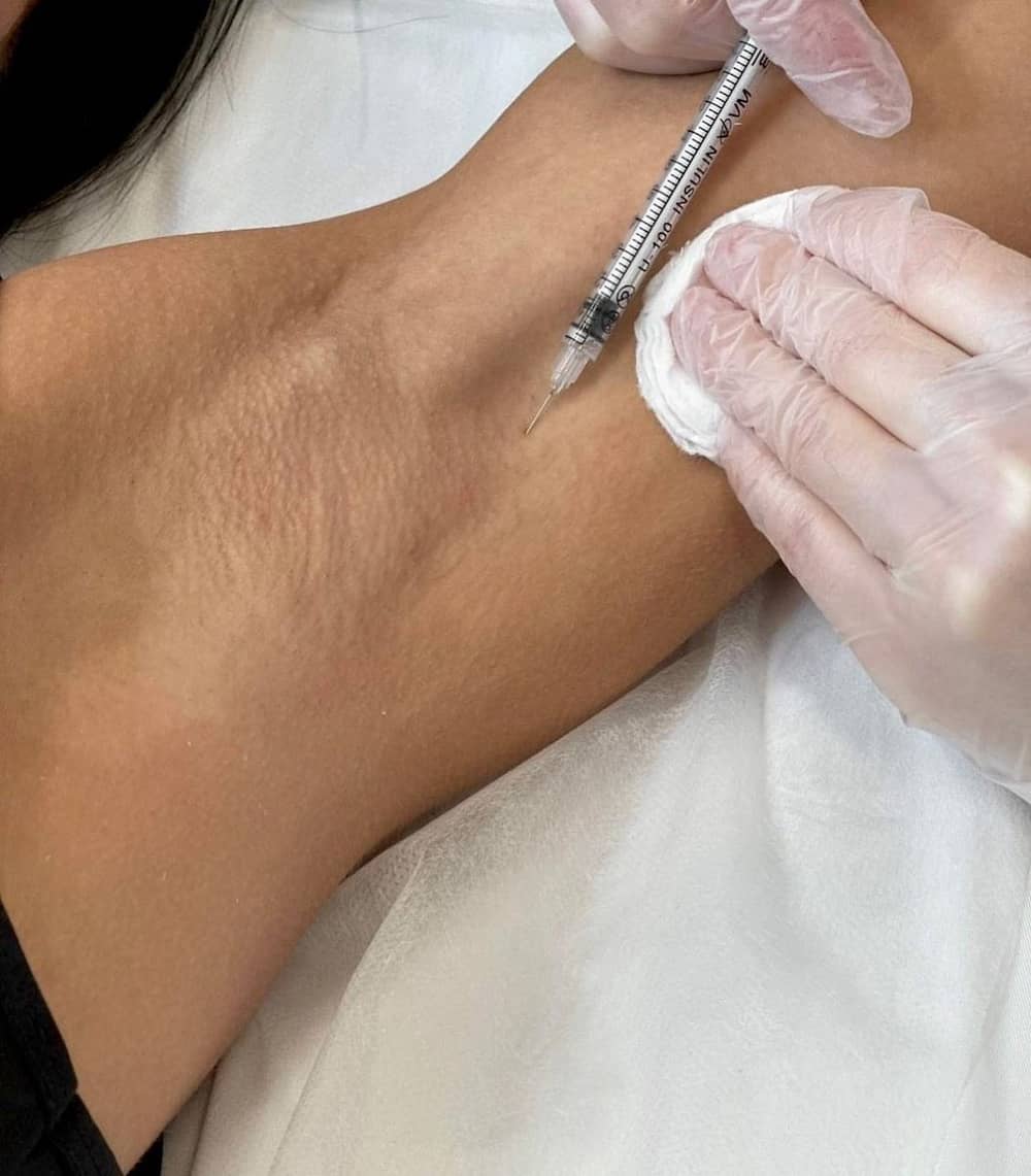 Tratamiento de hiperhidrosis en Clínica Bonome