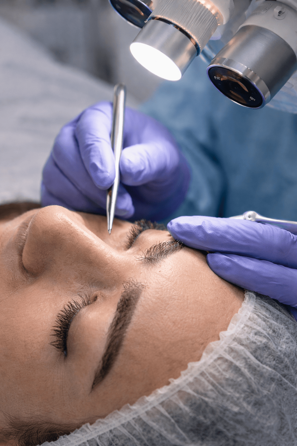 Reconstrucción de cejas en Clínica Bonome