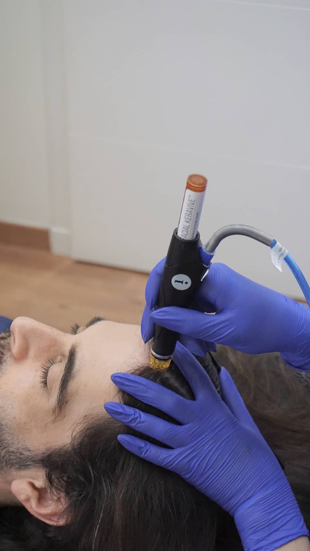 Hydrafacial Capilar Keravive en Clínica Bonome