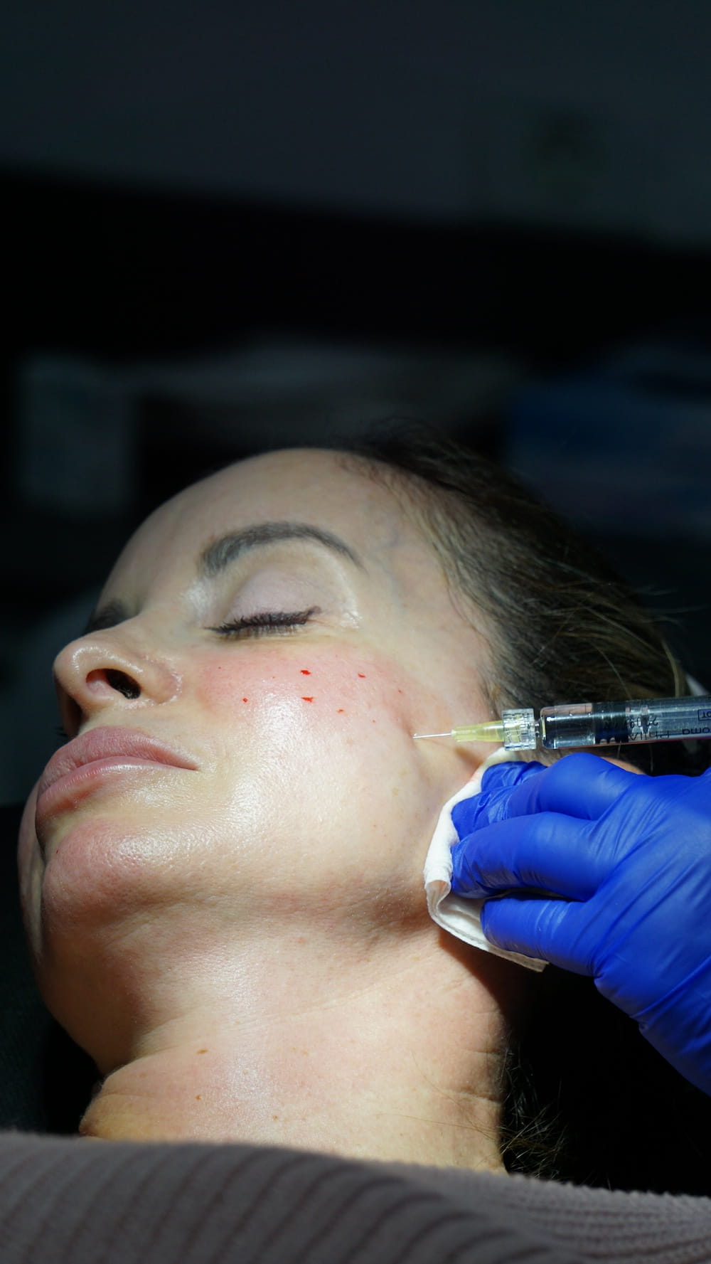 Revitalización y mesoterapia en Clínica Bonome